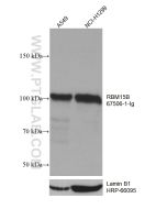 RBM15B Monoclonal antibody proteintech 67506-1-Ig