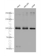 ITCH Monoclonal antibody proteintech 67757-1-Ig