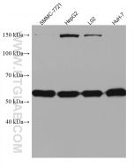 SLC2A9 Monoclonal antibody proteintech 67530-1-Ig