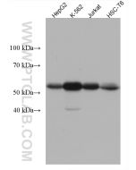 Beta Arrestin 1 Monoclonal antibody proteintech 67580-1-Ig