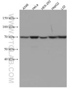 MUS81 Monoclonal antibody proteintech 67351-1-Ig