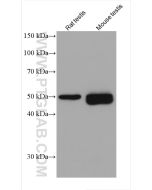 Acetyl-Tubulin (Lys40) Monoclonal antibody proteintech 66200-1-Ig