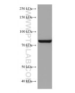 TGM2 Monoclonal antibody proteintech 68006-1-Ig