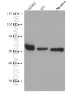 Occludin Monoclonal antibody proteintech 66378-1-Ig