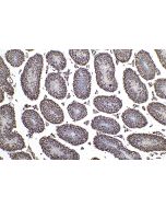 5-methylcytosine Monoclonal antibody proteintech 68301-1-Ig