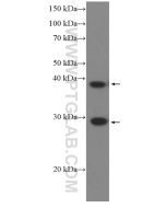 DNAJB6 Monoclonal antibody proteintech 66587-1-Ig