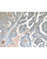 MUC16/CA125 Monoclonal antibody proteintech 60261-1-Ig