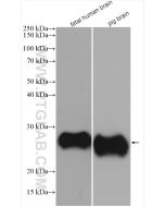 CD90 Monoclonal antibody proteintech 66766-1-Ig