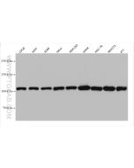 MTHFD1 Monoclonal antibody proteintech 67670-1-Ig