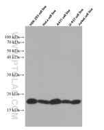 SURVIVIN Monoclonal antibody proteintech 66495-1-Ig