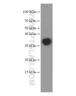 CLTB Monoclonal antibody proteintech 66270-1-Ig