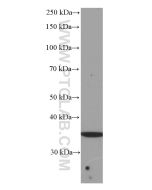 SIRT4 Monoclonal antibody proteintech 66543-1-Ig