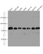 MTMR14 Monoclonal antibody proteintech 67561-1-Ig