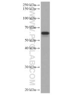TAB1 Monoclonal antibody proteintech 67020-1-Ig