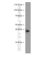 ERCC1 Monoclonal antibody proteintech 66275-1-Ig