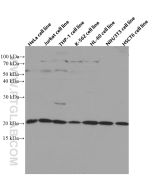 TWIST2 Monoclonal antibody proteintech 66544-1-Ig