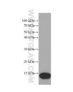 CRABP2 Monoclonal antibody proteintech 66468-1-Ig