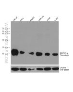 Thioredoxin Monoclonal antibody proteintech 66475-1-Ig