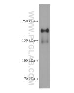 PTPRO Monoclonal antibody proteintech 67000-1-Ig