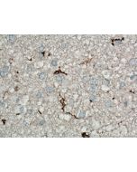 human IBA1 Monoclonal antibody proteintech 66827-1-Ig