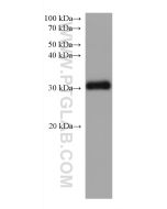STAR Monoclonal antibody proteintech 67130-1-Ig