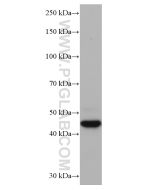 Cathepsin L Monoclonal antibody proteintech 66914-1-Ig
