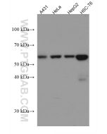 UGDH Monoclonal antibody proteintech 67360-1-Ig