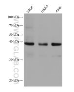 TMEM106B (1-46aa) Monoclonal antibody proteintech 60333-1-Ig