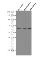 P4HA1 Monoclonal antibody proteintech 66101-1-Ig