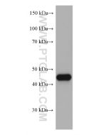 Serpin E1/PAI-1 Monoclonal antibody proteintech 66261-1-Ig