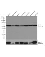 P2RY1 Monoclonal antibody proteintech 67654-1-Ig