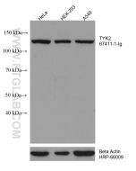 TYK2 Monoclonal antibody proteintech 67411-1-Ig