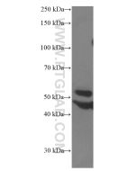 PARK2/Parkin Monoclonal antibody proteintech 66674-1-Ig