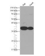 CD74 Monoclonal antibody proteintech 66390-1-Ig