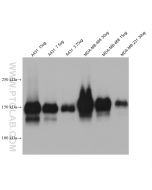 EGFR Monoclonal antibody proteintech 66455-1-Ig