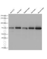 SDHA Monoclonal antibody proteintech 66588-1-Ig