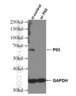 NF-κB p65 Monoclonal antibody proteintech 66535-1-Ig