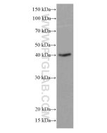 CD23 Monoclonal antibody proteintech 60208-2-Ig