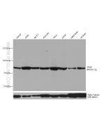 PFKP Monoclonal antibody proteintech 68129-1-Ig