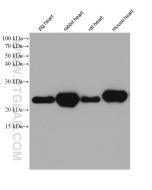 MYL6 Monoclonal antibody proteintech 68142-1-Ig