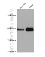 PLA2G4A Monoclonal antibody proteintech 68133-1-Ig