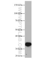 ZFP36 Monoclonal antibody proteintech 66938-1-Ig