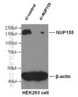 NUP155 Monoclonal antibody proteintech 66359-1-Ig