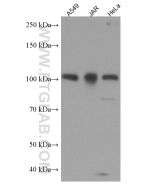 FURIN Monoclonal antibody proteintech 67481-1-Ig
