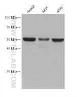 PPAR Gamma Monoclonal antibody proteintech 66936-1-Ig