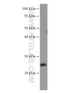 LIN28A Monoclonal antibody proteintech 60344-1-Ig