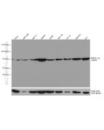 TOM70 Monoclonal antibody proteintech 66593-1-Ig