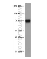 human IgD Monoclonal antibody proteintech 67538-1-Ig
