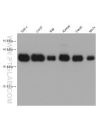 CD23 Monoclonal antibody proteintech 60208-1-Ig
