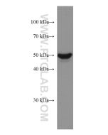 GSDMB Monoclonal antibody proteintech 67527-1-Ig